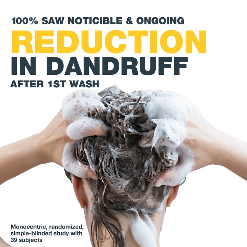 Nizoral Daily Care Anti Dandruff Shampoo For Oily Scalp 200ml 