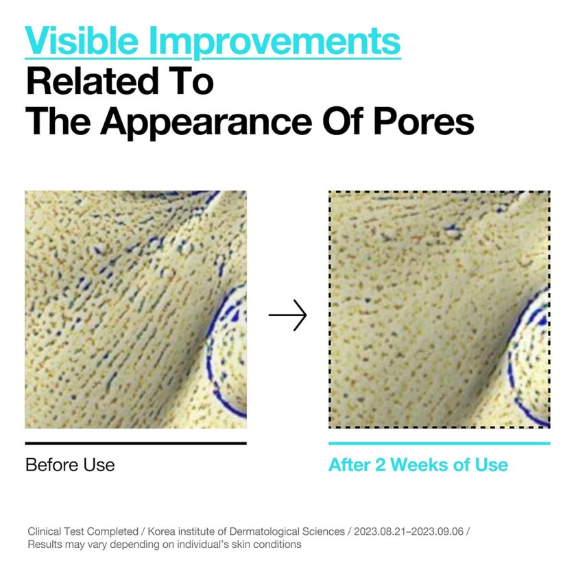 Anua BHA 2 + Ceramides Gentle Exfoliating Face Toner 150ml