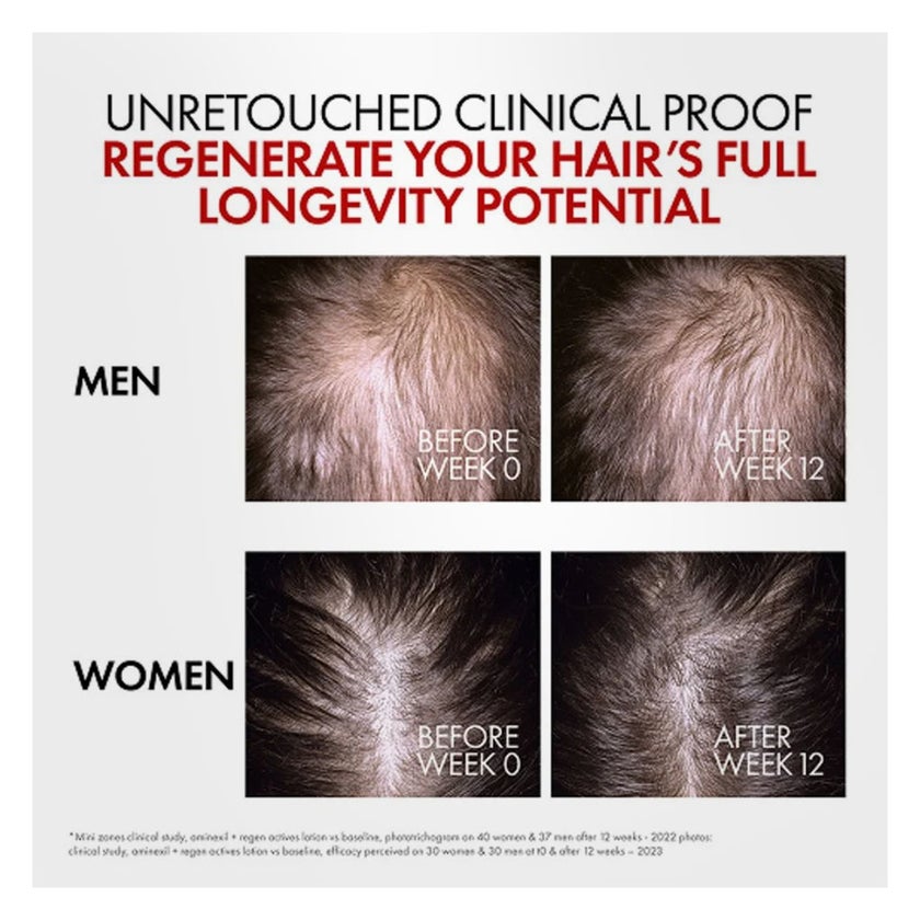 Vichy Dercos Aminexil Clinical REGEN Booster Hair Serum 90ml