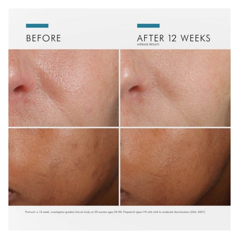 SkinCeuticals Phloretin CF Vitamin C Serum, Anti-Aging - 30ml