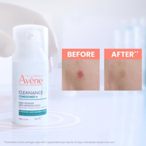 Avene Cleanance Comedomed Anti-Blemish Concentrate For Acne Prone Skin 30ml
