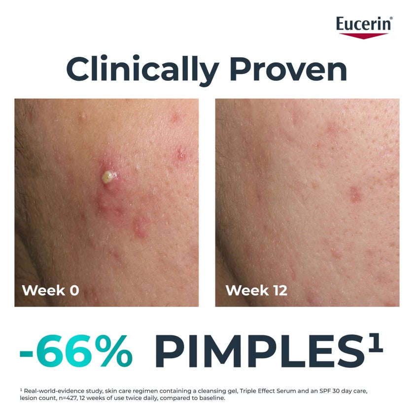 Eucerin DermoPurifyer Oil Control Post Acne Marks Triple Effect Serum 40ml