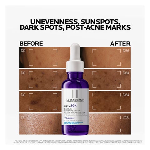 La Roche-Posay Mela B3 Niacinamide Anti-Dark Spots Serum, All Skin Types - 30ml