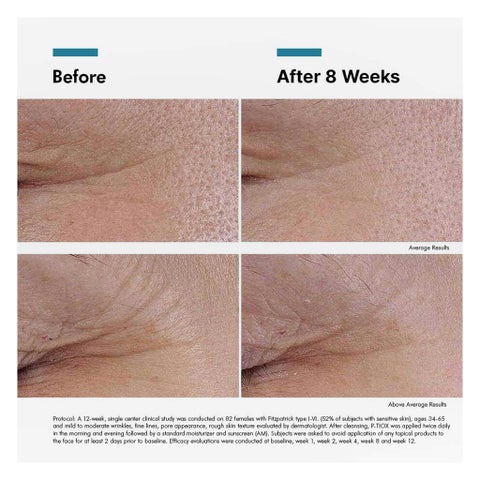 SkinCeuticals P-TIOX Peptide Serum, Anti-Wrinkles - 30ml