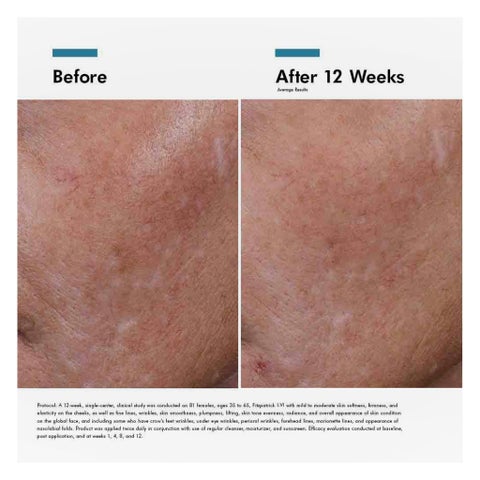 SkinCeuticals Hyaluronic Acid Intensifier Multi-Glycan Serum - 30ml
