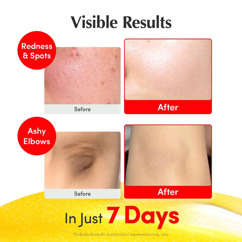 Eqqualberry Glow Filter Vitamin Illuminating Serum 30ml