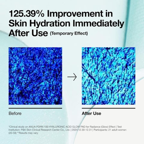 Anua PDRN 100 Hyaluronic Acid Glow Pad 180ml - 60 Pads