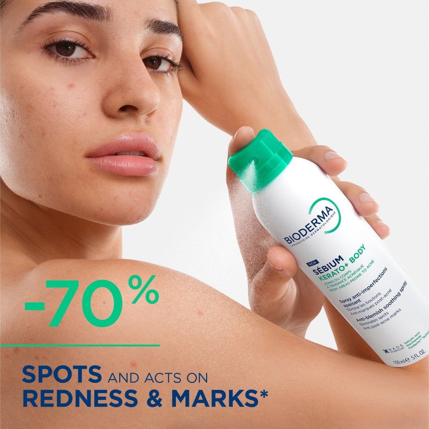 Bioderma Sebium Kerato+ Body Anti-Blemish Soothing Spray - 150ml