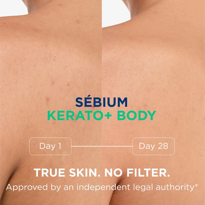 Bioderma Sebium Kerato+ Body Anti-Blemish Soothing Spray - 150ml