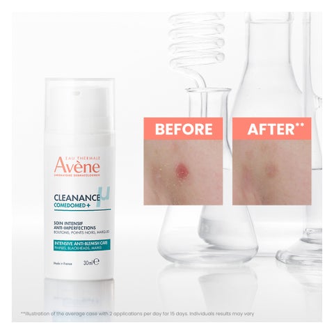 Avene Cleanance Comedomed+ Intensive Anti-Blemish Care - 30ml