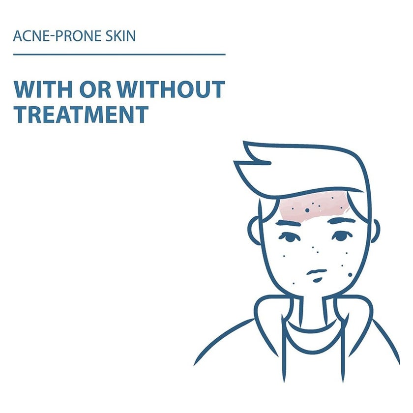 Ducray Keracnyl Foaming Gel 200ml