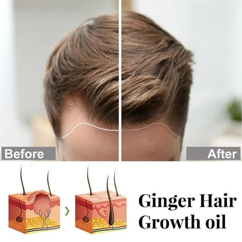 Hairgrow 5% Minoxidil Topical Solution For Men 50ml