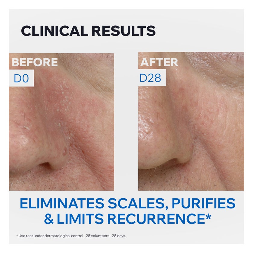 Uriage DS Regulating Soothing Emulsion, Irritation Prone Skin - 40ml