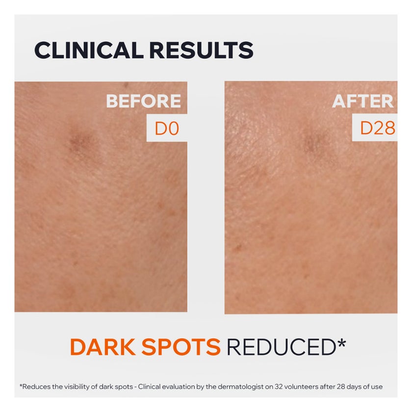 Uriage Depiderm Anti-Dark Spot Serum, Brightening Booster - 30ml