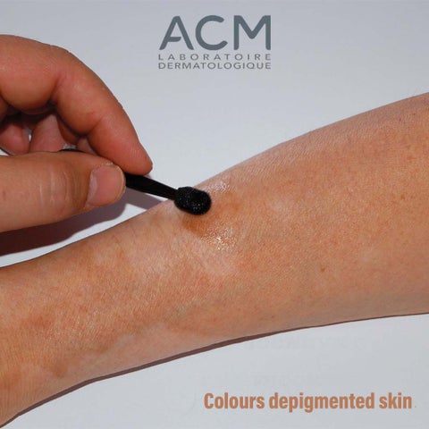 ACM Viticolor Durable Skin Camouflage Gel For Depigmented Skin 50ml