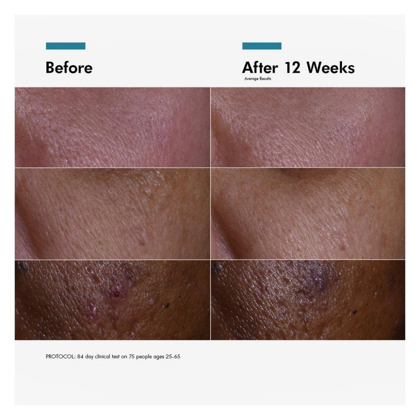 SkinCeuticals C E Ferulic Anti-Aging, Vitamin C Serum - 30ml