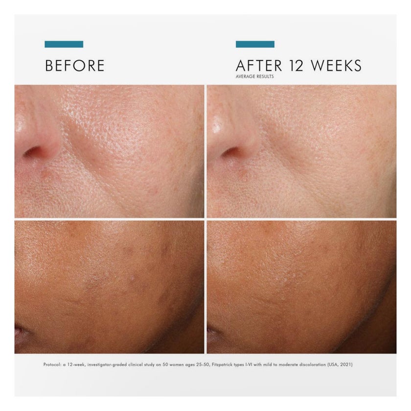 SkinCeuticals Phloretin CF Anti-Aging, Vitamin C Serum - 30ml