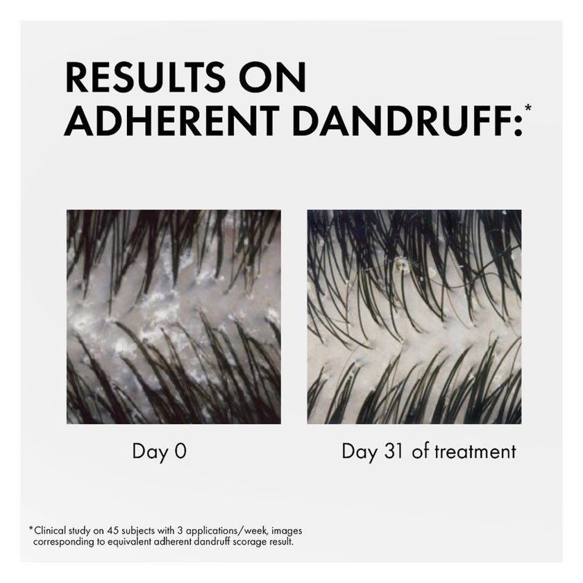 Vichy Dercos Anti Dandruff Shampoo For Dry Hair 200ml