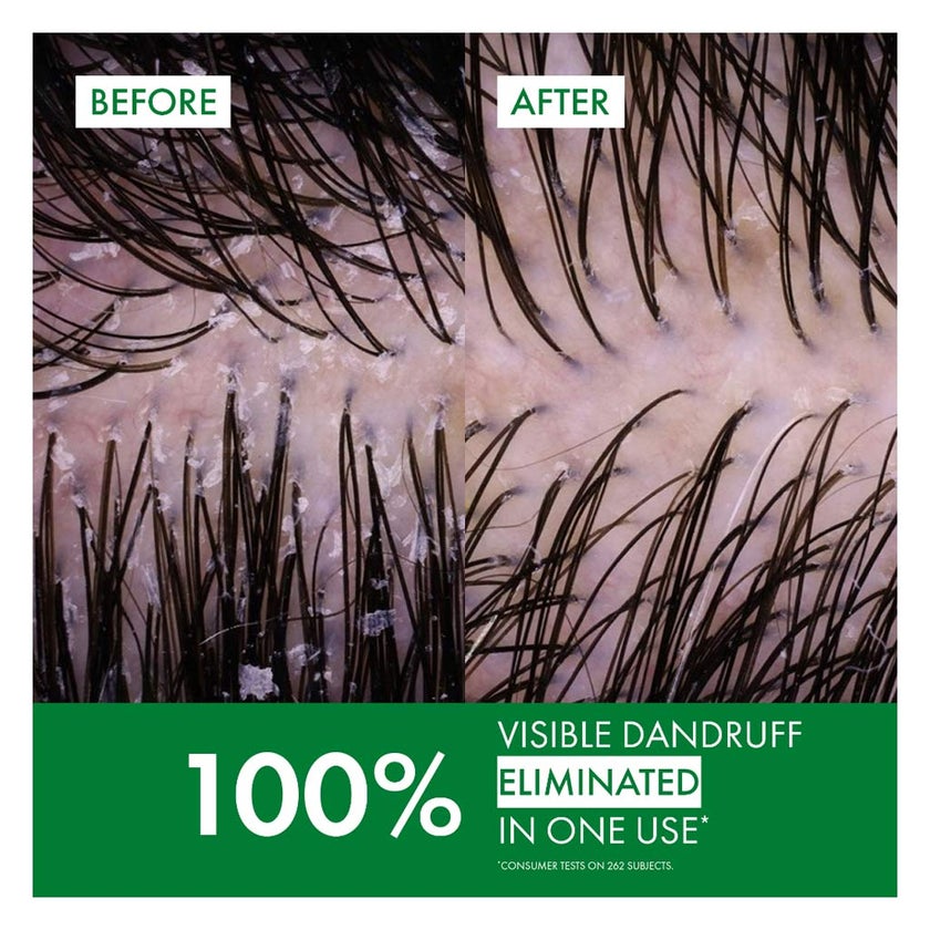 Vichy Dercos Anti Dandruff Shampoo, Normal To Oily Hair 200ml