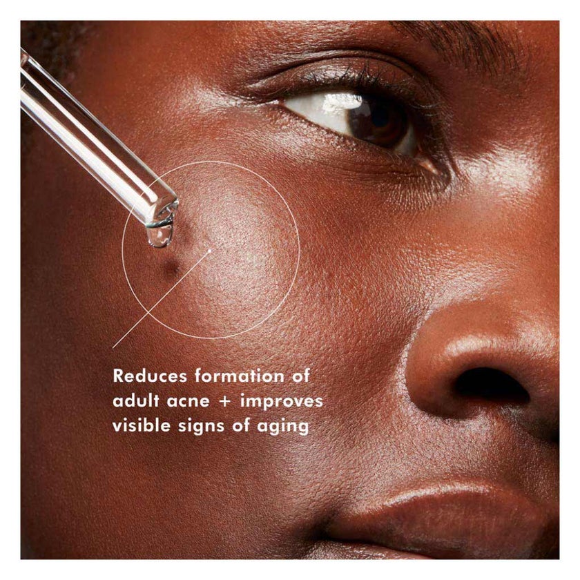 SkinCeuticals Blemish + Age Defense Serum - 30ml