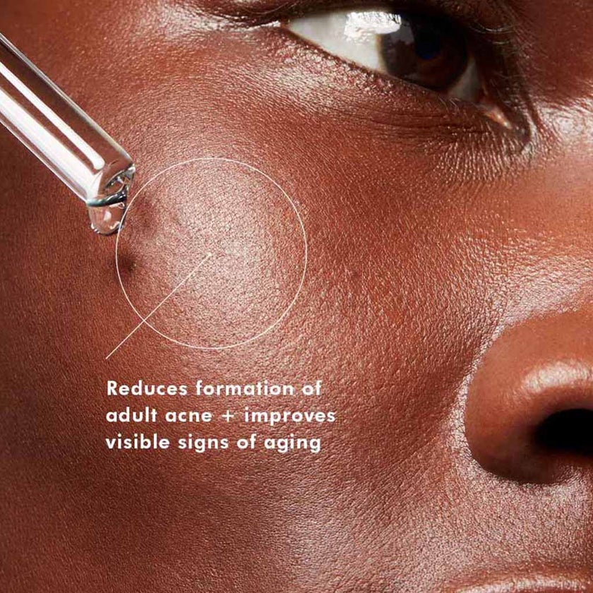 Skinceuticals Blemish + Age Defense Facial Serum With Salicylic Acid & Glycolic Acid 30ml