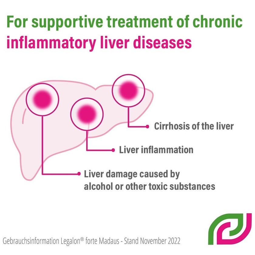 Legalon Forte 140mg Capsules, Pack of 100's