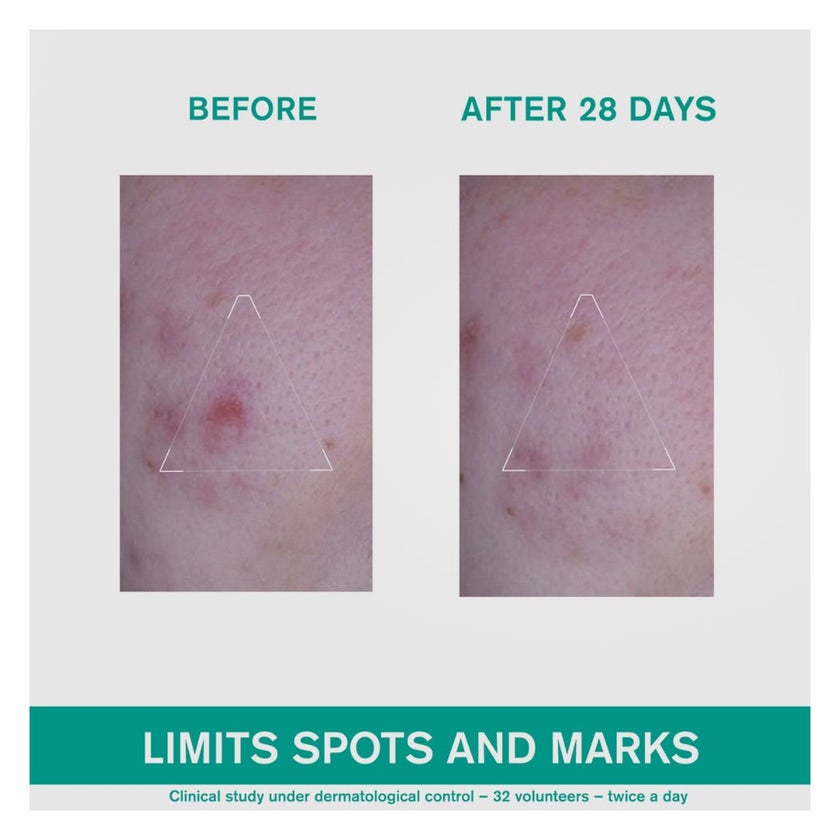 Uriage Hyseac 3-REGUL+ Global Anti Blemish Care Cream 30ml