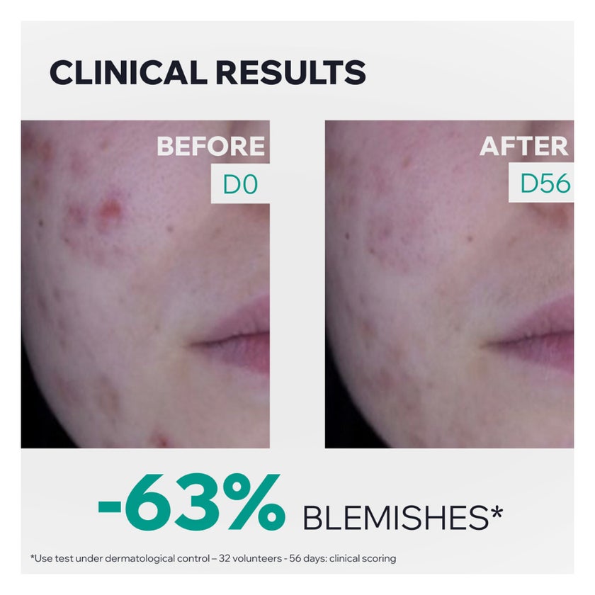 Uriage Hyseac 3-REGUL+ Global Anti Blemish Care, Oily Skin - 30ml