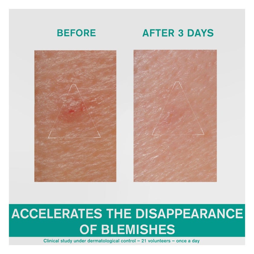 Uriage Hyseac SOS Paste For Spot Control 15g