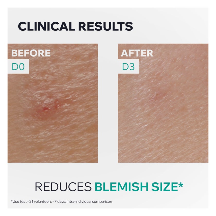 Uriage Hyseac SOS Paste, Spot Control - 15g