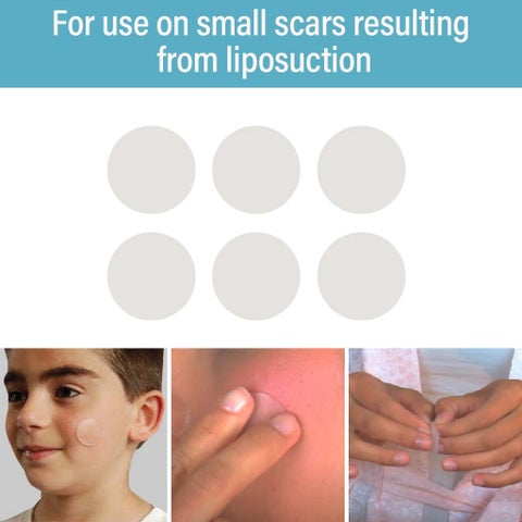 NewGel+ Advanced Medical-Grade Silicone Gel Dots, NG-380 Clear, Pack of 6's