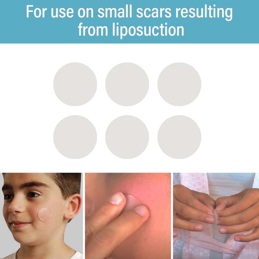 NewGel+ Advanced Medical-Grade Silicone Gel Dots, NG-380 Clear, Pack of 6's