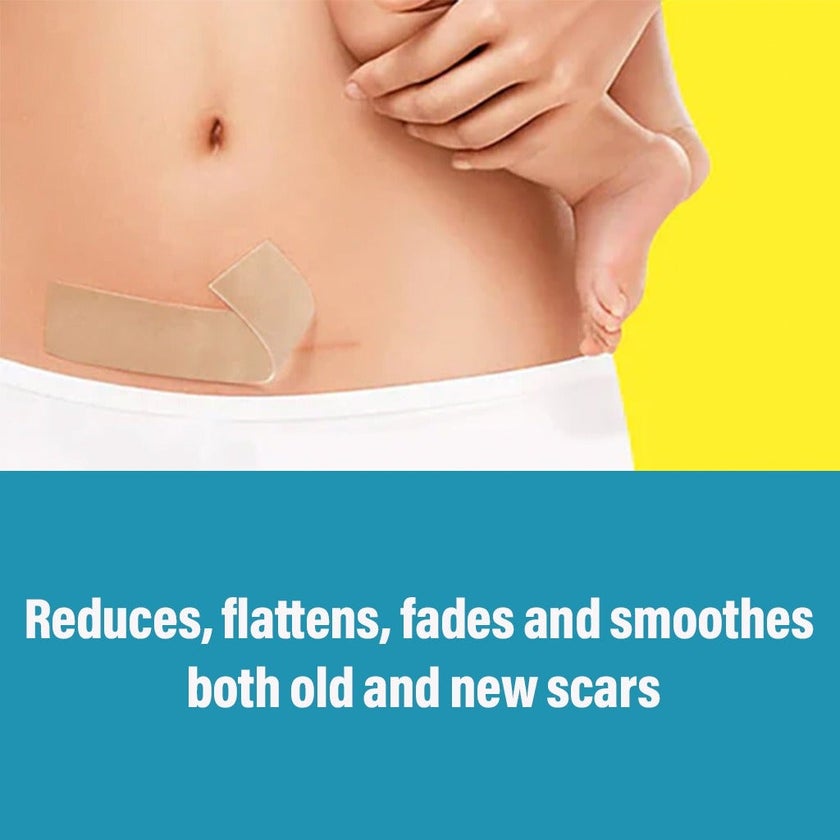 NewGel+ Advanced Medical-Grade 2" x 8" C-Section Strip For C-Section Scar Management, NG-160 Beige