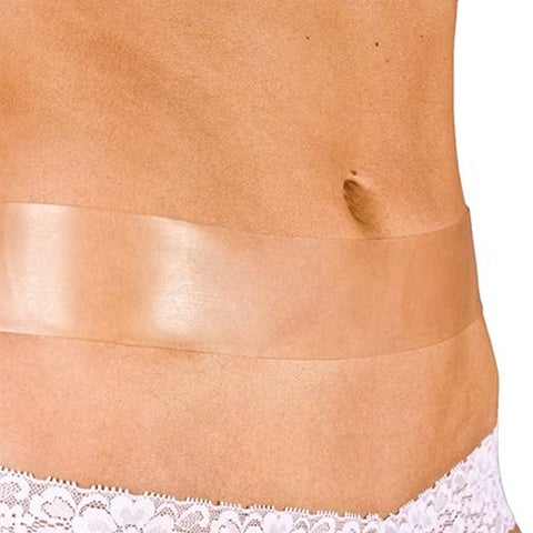 NewGel+ Silicone Gel Strips For Scar Marks - NG-364