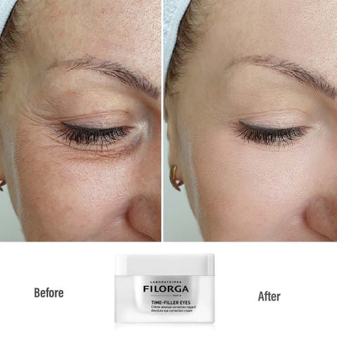 Filorga Time Filler Eyes 15ml