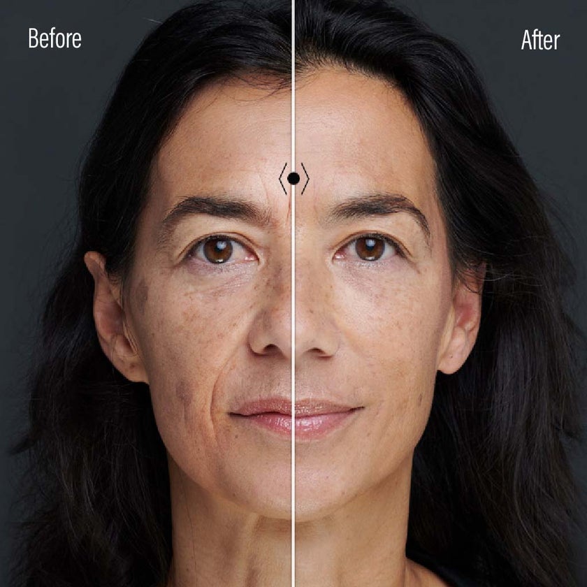 Filorga NCTF Reverse Mat Supreme Regenerating Fluid 50ml