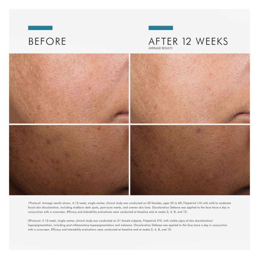 SkinCeuticals Discoloration Defense 5% Niacinamide Serum - 30ml