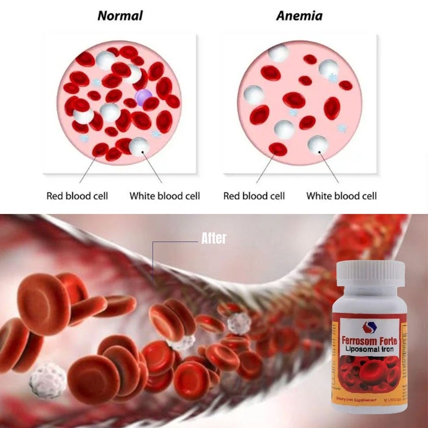 Ferrosom Forte Liposomal Iron Capsule, Pack of 30's