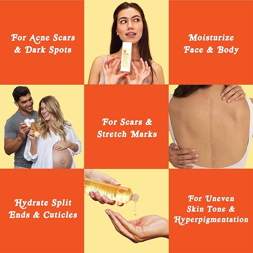 Bio-Oil Natural Skincare Oil For Scars & Stretch Marks 60ml