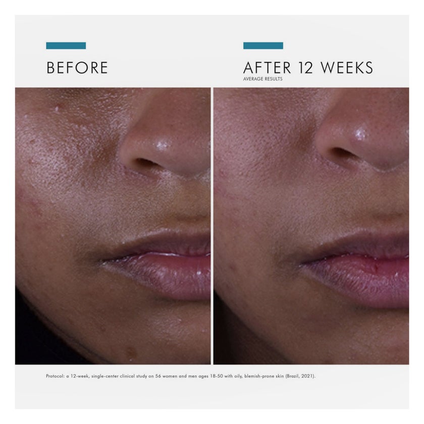 SkinCeuticals Silymarin CF Anti-Aging, Vitamin C Serum - 30ml