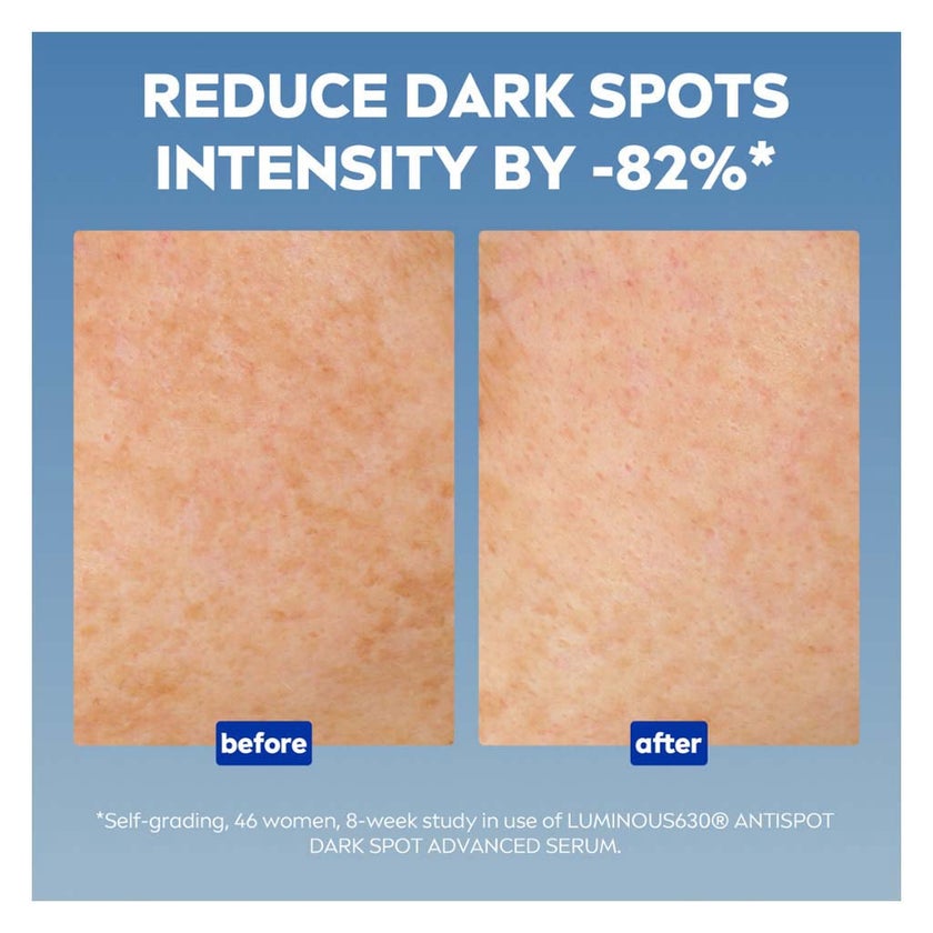 Nivea Luminous630 Even Glow Concentrated Serum For Dark Spots 30ml