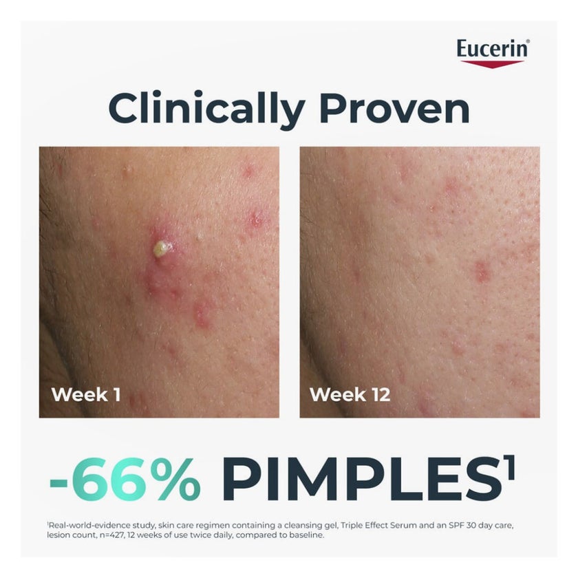 Eucerin DermoPurifyer Oil Control Post Acne Marks Triple Effect Serum 40ml
