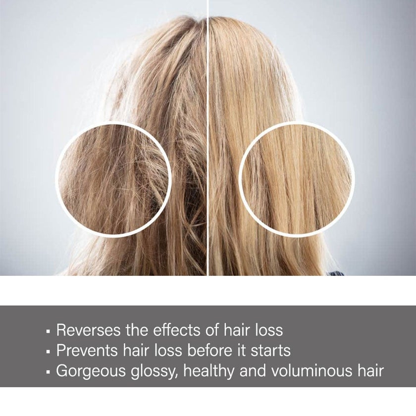 Regrow Step 1 -Cleanse & Prepare Shampoo For Women 300ml