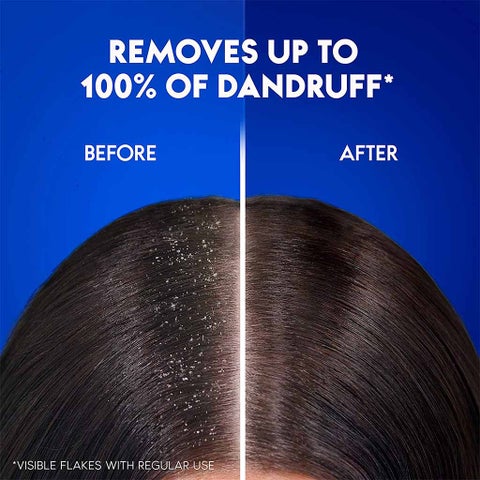 Head & Shoulders Smooth & Silky Anti-Dandruff Paraben-Free Shampoo For Dry & Frizzy Hair 190ml