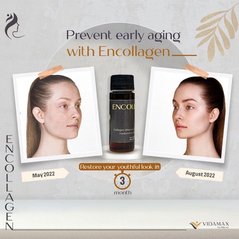 Vidamax Encollagen Collagen Drinkable Shots, Anti-Aging - 50ml x 10