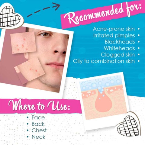 Bye Bye Blemish For Acne Drying Lotion 30ml