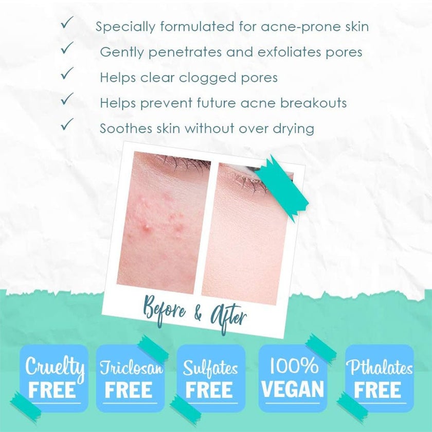 Bye Bye Blemish Anti Acne Cleanser With Menthol 236ml