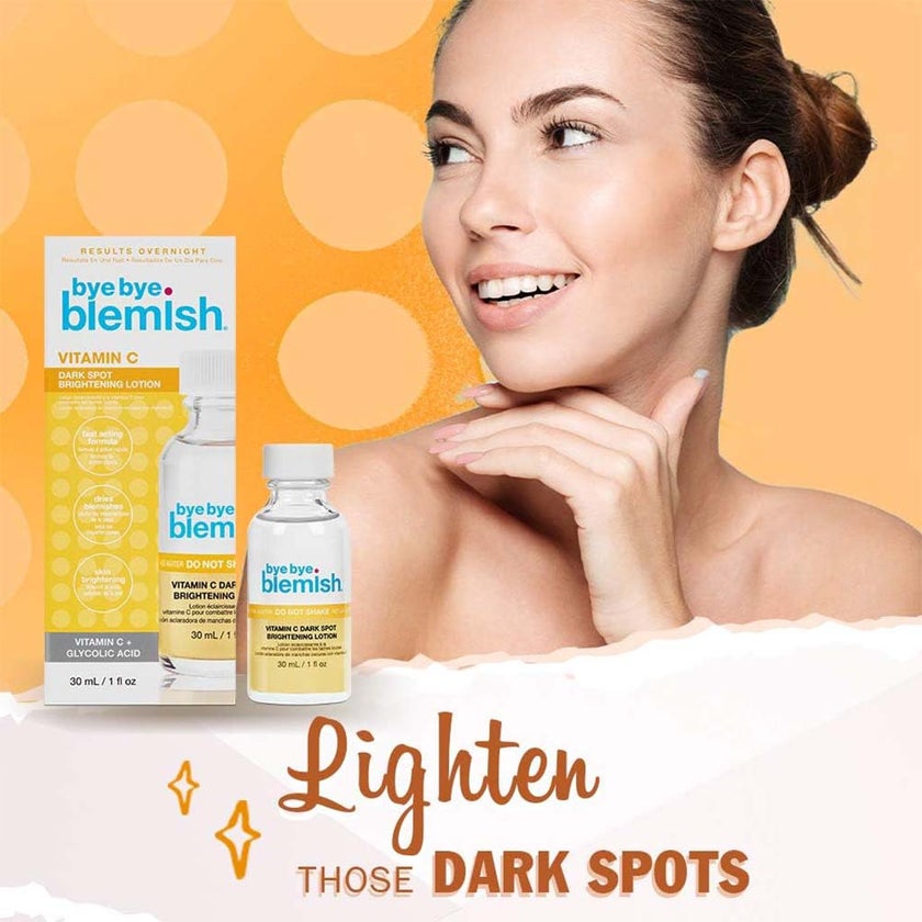 Bye Bye Blemish Vitamin C Dark Spot Brightening Lotion 30ml
