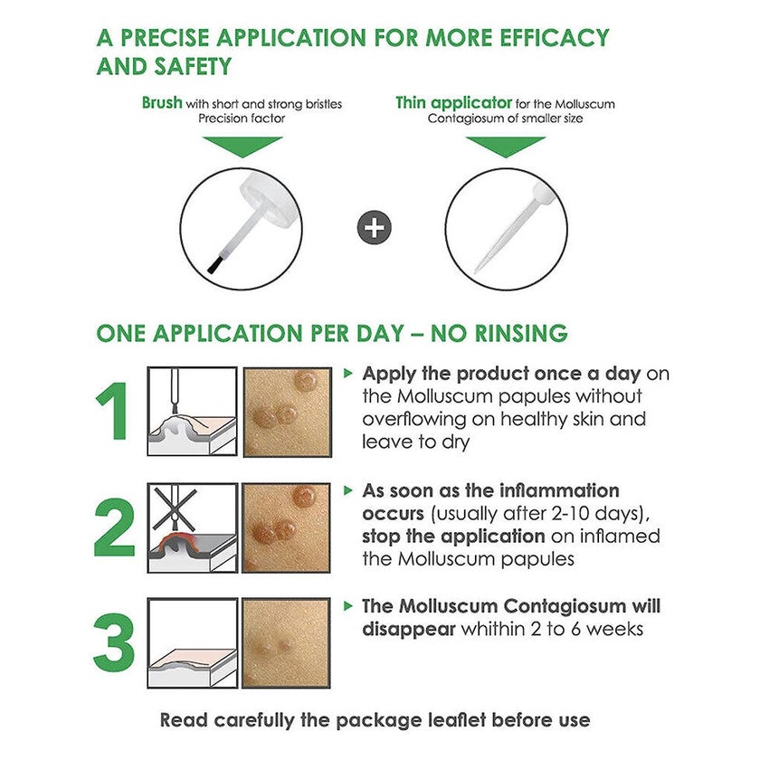 ACM Molutrex 5% Potassium Hydroxide Topical Solution For Molluscum Contagiosum 3ml