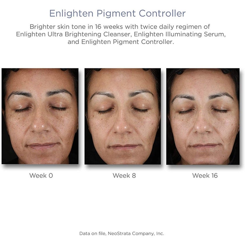 Neostrata Enlighten Pigment Controller Fluid For Dark spots and Uneven skin tone 50ml